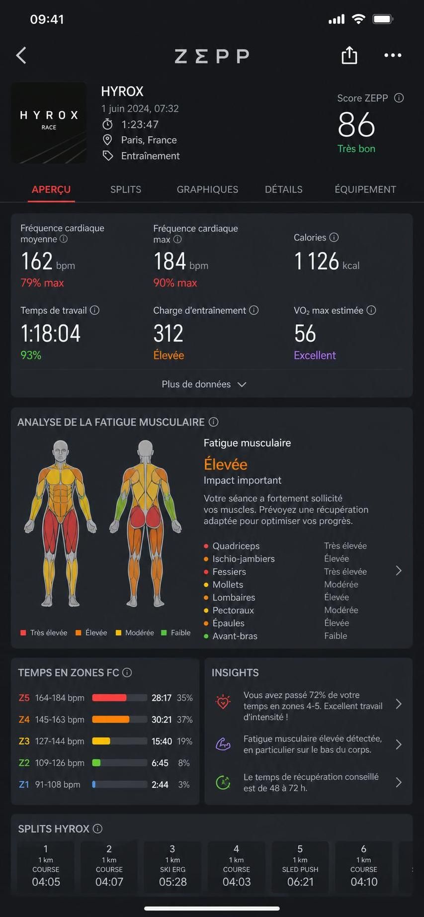 découvrez l'amazfit helio strap pro, le bracelet multi-capteurs innovant conçu spécialement pour les athlètes hyrox et les entraînements hybrides, alliant précision et performance.